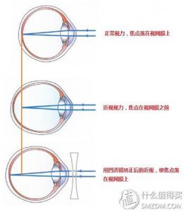 ​近视眼镜店一般用的什么镜片（近视眼镜购买攻略之镜片）