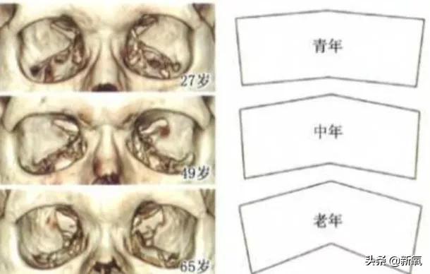 眼睛构造详细图解（根据眼眶结构来判断和修正自己的眼部光影美感）(16)