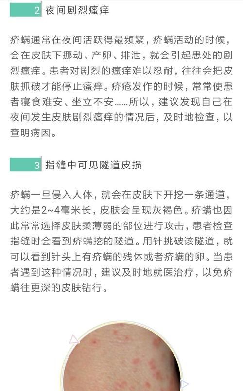 疥虫会越过被罩爬到被子上吗