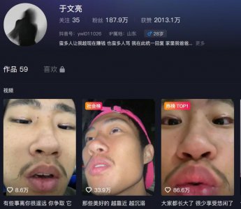 ​抖音10天涨粉百万的于文亮是谁 网友：他治好了我的“平凡羞耻症”