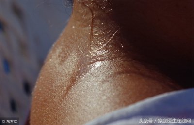 ​女人除湿气最好的方法（湿气重的女性皮肤容易暗沉 这3点让你的湿气减少）